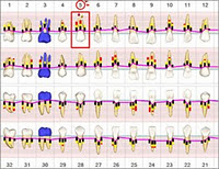 Periodontal Disease Rochester, MI