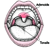 Tonsils