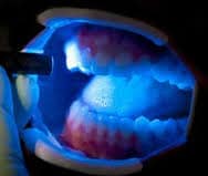 oi - Rochester Advanced Dentistry oi