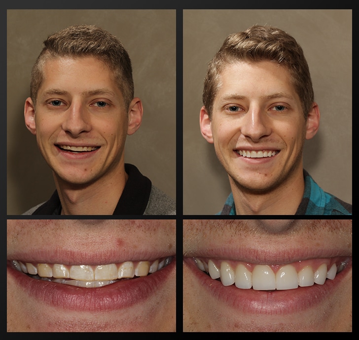 Will's portrait and smile close up before and after dental treatment