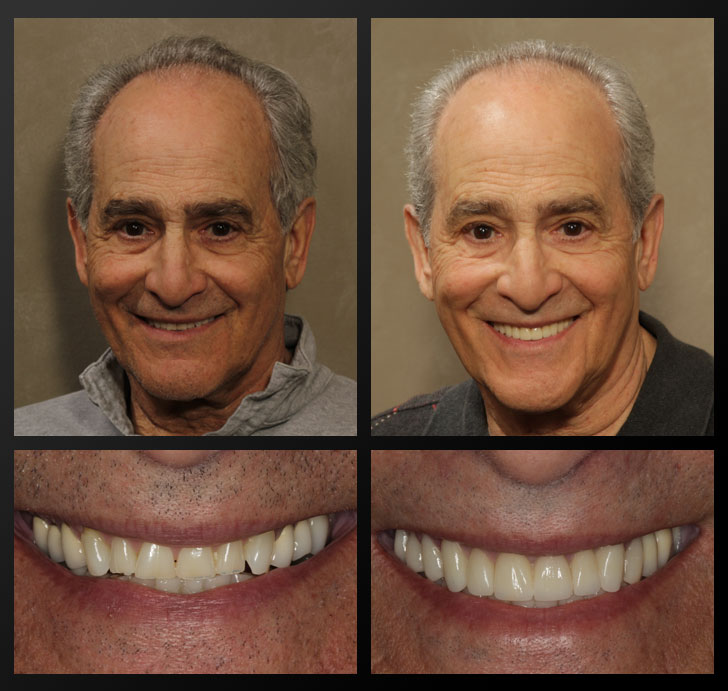 Dale Before and After