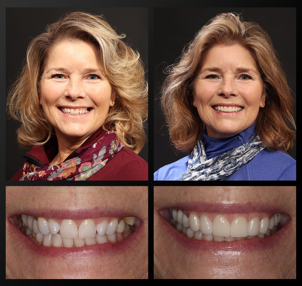 patient portrait smiling