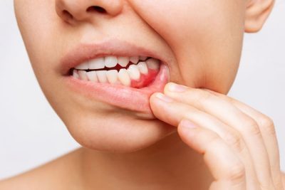 woman looking at her gums