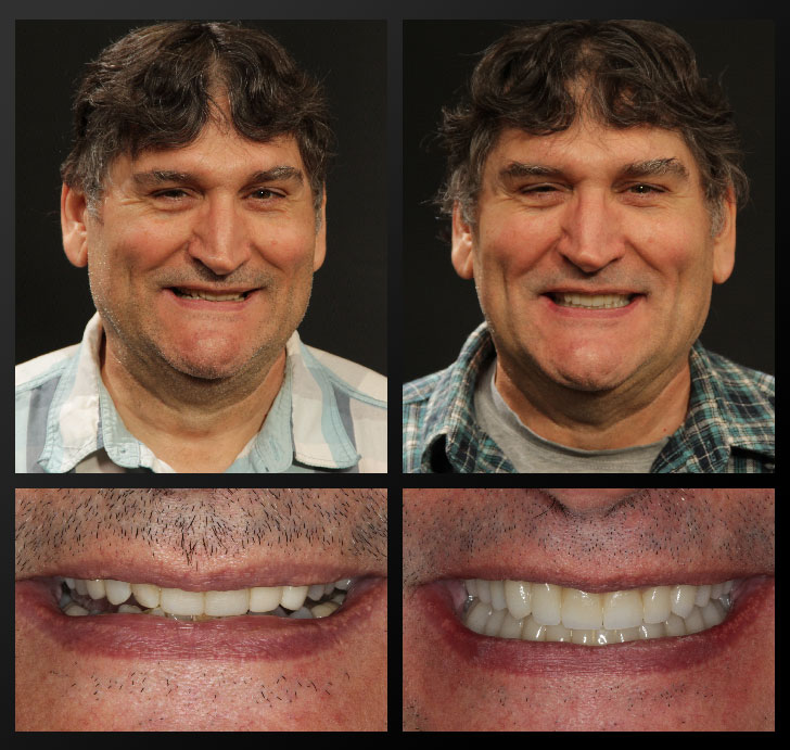 smile gallery patient before after