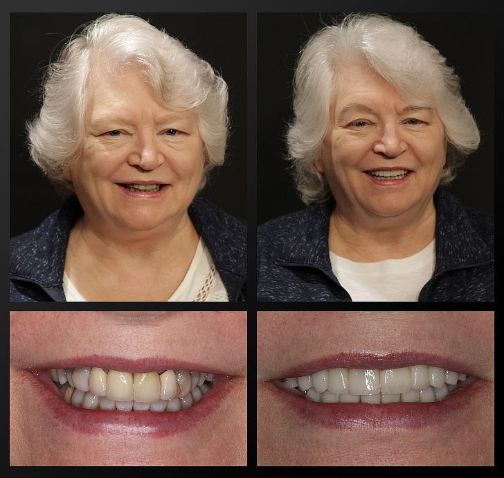 kathy-Haddad-Patient-Before-and-After patient before and after