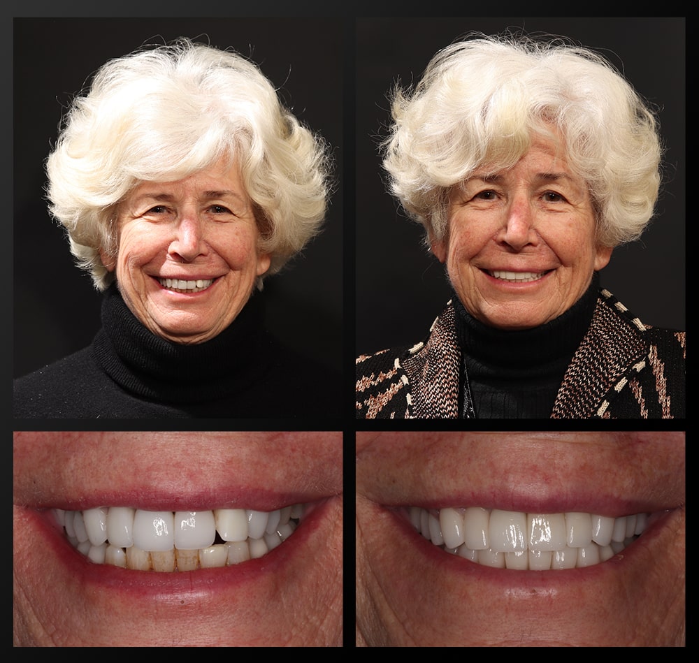patient portrait smiling
