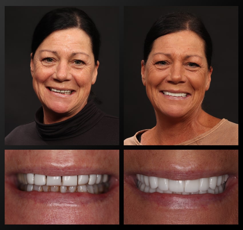 rochester patient before and after collage
