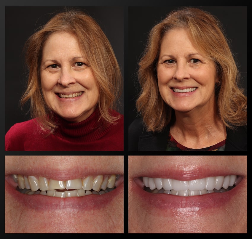 patient before and after