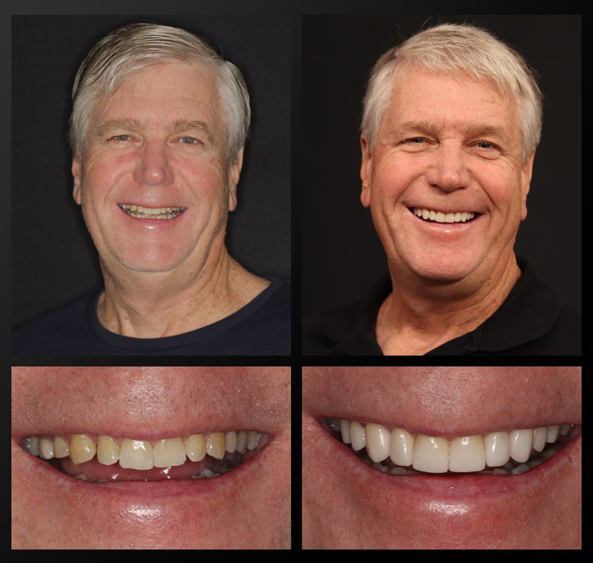 patient before and after