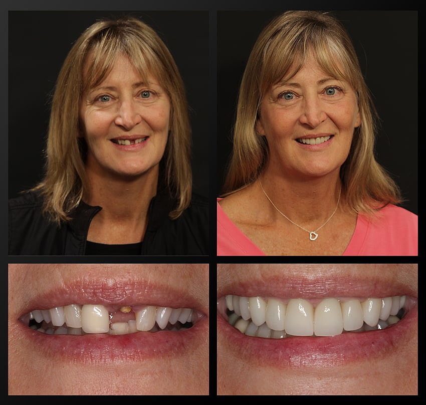 patient before and after