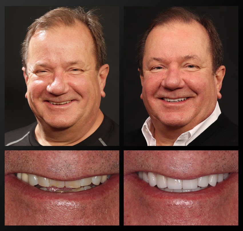patient before and after collage