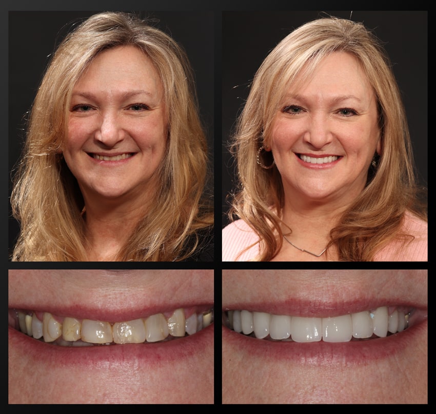 patient before and after collage