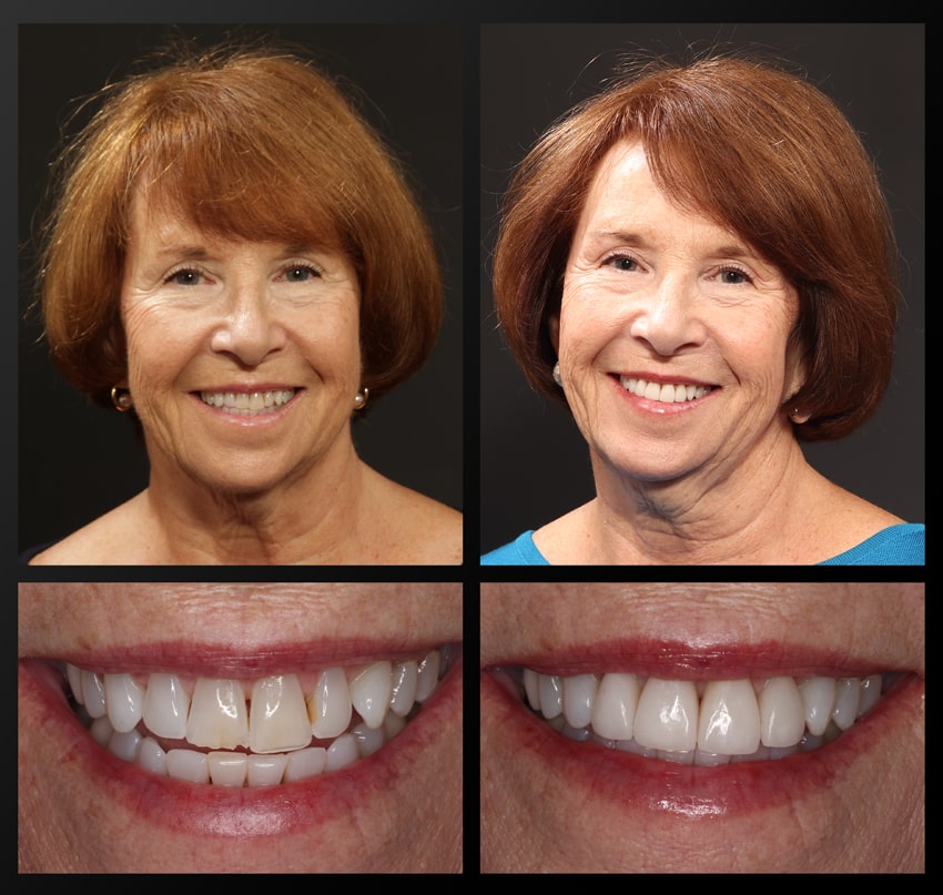patient before and after collage
