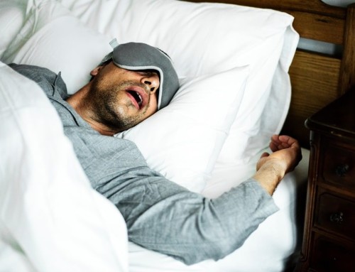 How Dentists Manage Sleep Apnea