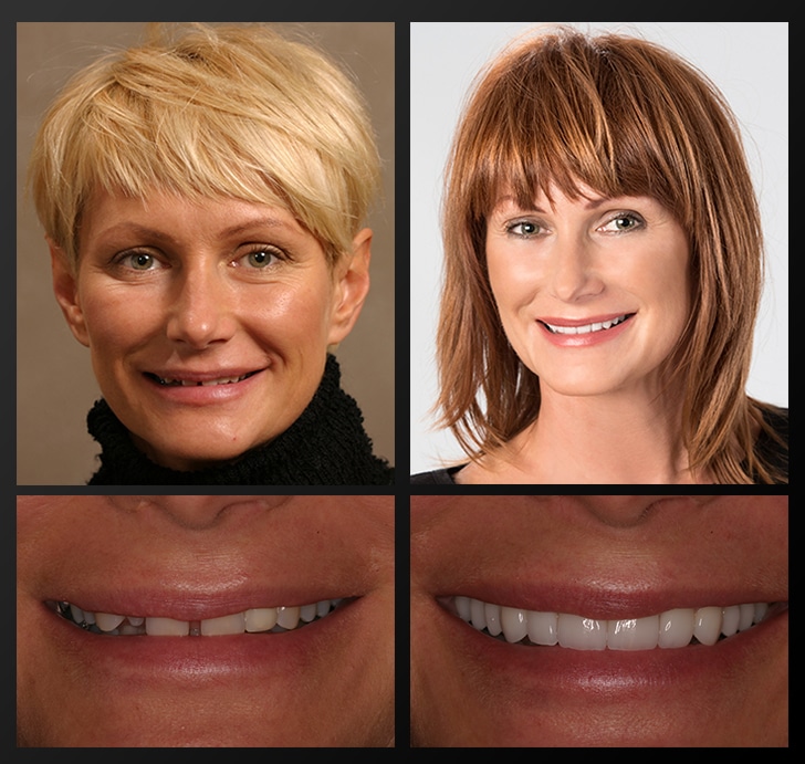 Nadia before and after