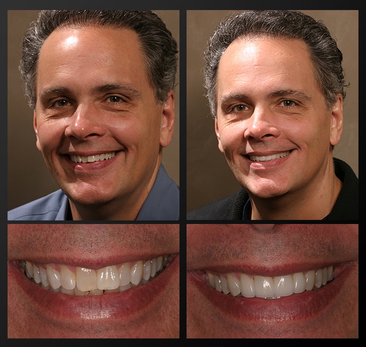 Cosmetic dentistry patient