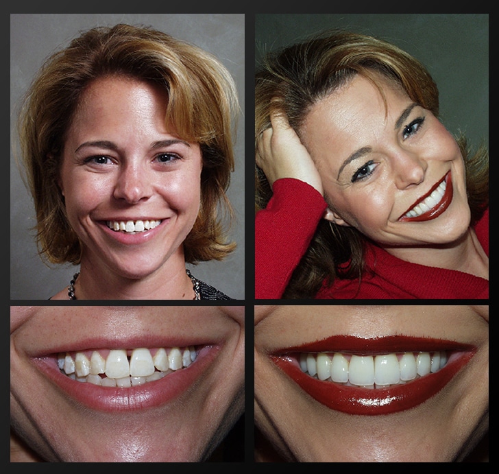 Cosmetic dentistry patient
