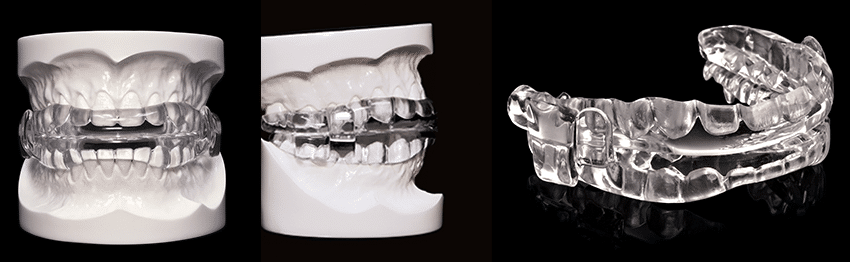 MicrO2 Oral Device