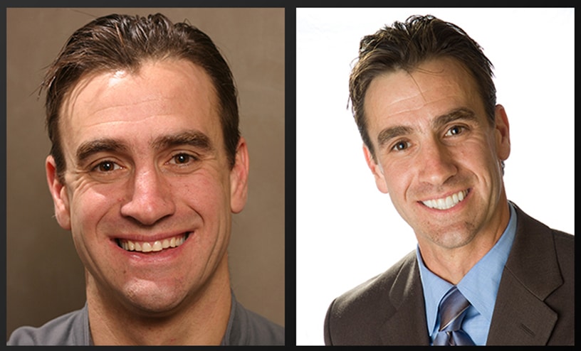 getting a fixed 5 key questions to ask before getting a chipped tooth fixed getting a fixed 5 key questions to ask before getting a chipped tooth fixed