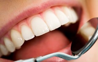 Close up of a patient's mouth during a check up