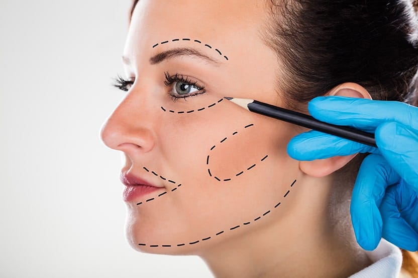 Surgeon Drawing Correction Lines On Young Woman Face for a face lift - which will leaves scars. A Non-surgical facelift will offer the lift but none of the scars