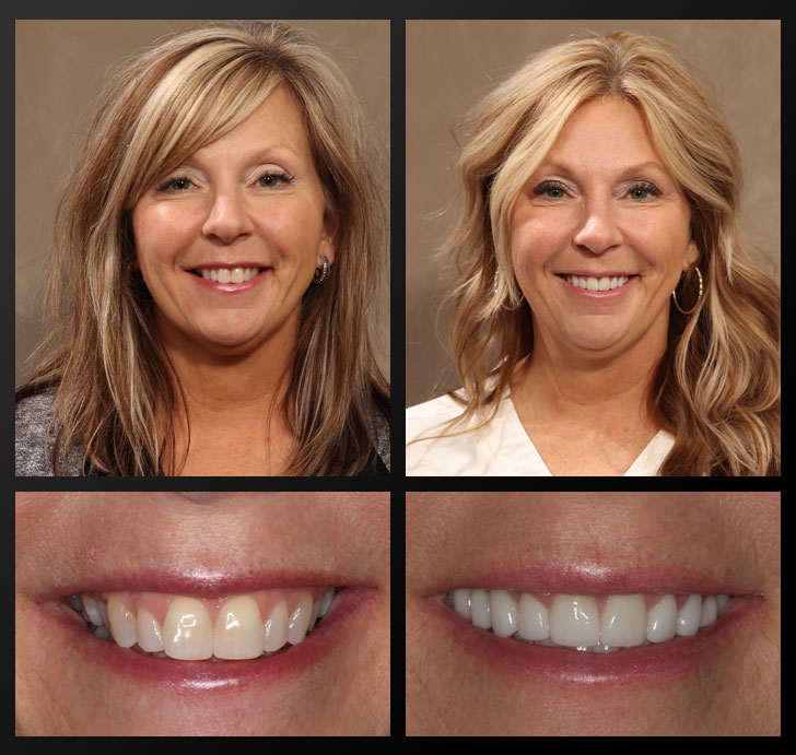 Betsey Before and After