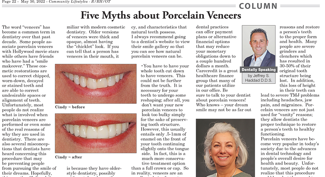 Five Myths about Porcelain Veneers