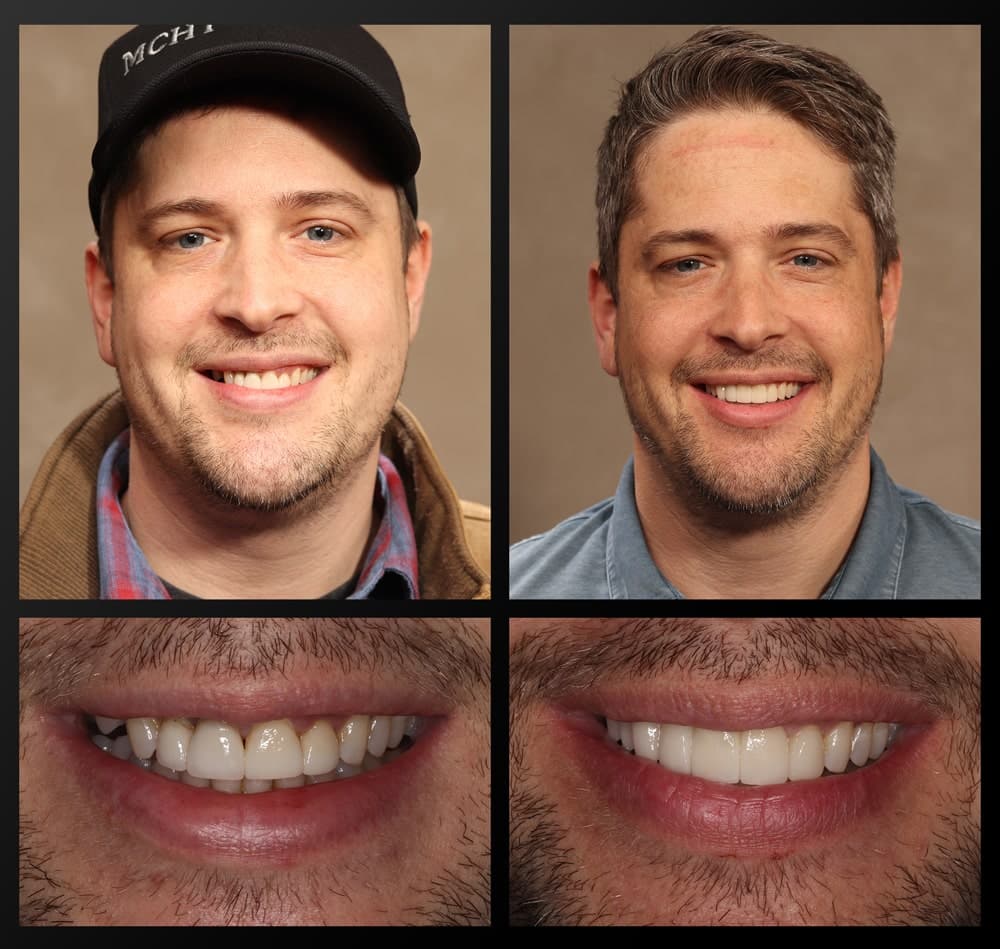 smile gallery patient before and after