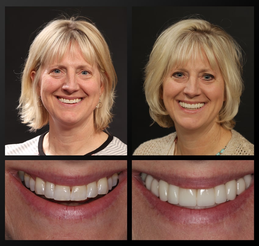 patient before and after collage